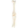 Knee Joint Bone Keyring