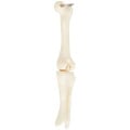 Knee Joint Bone Keyring