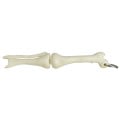 Knee Joint Bone Keyring
